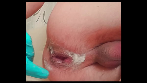 Jovencito flaco y guapo con prolapso roto se hace un puño a sí mismo